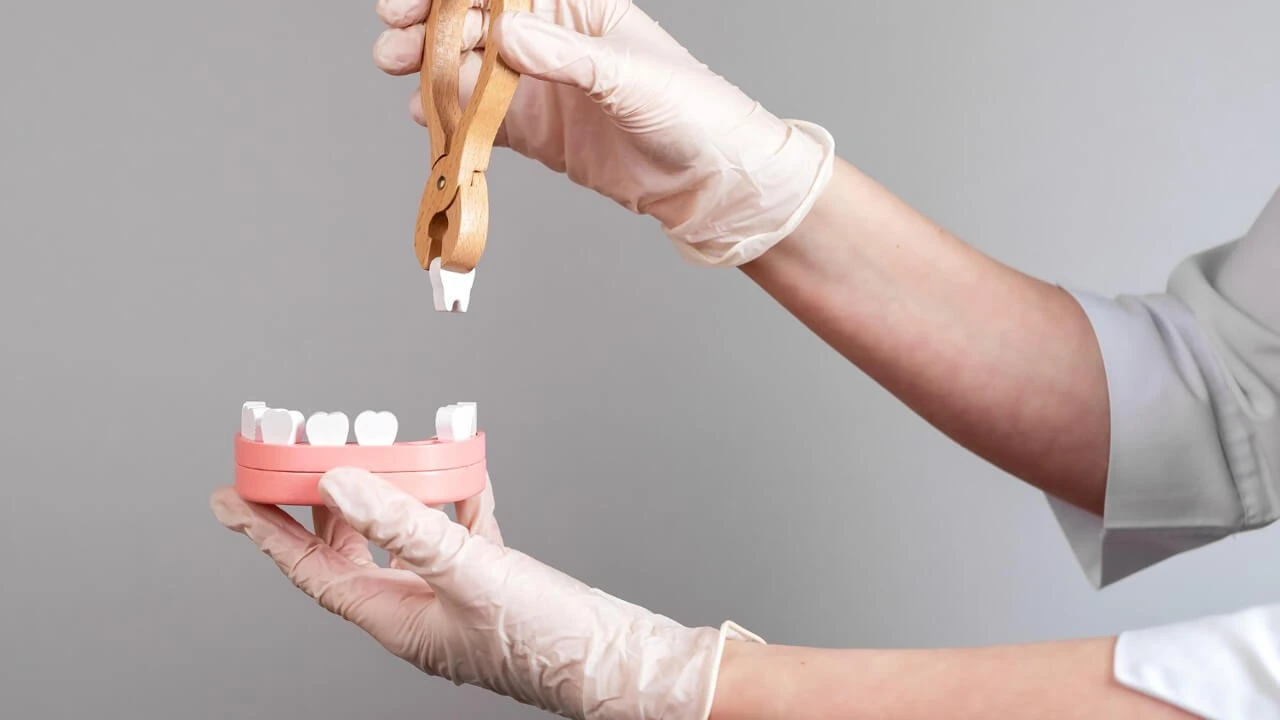 Tooth Extraction